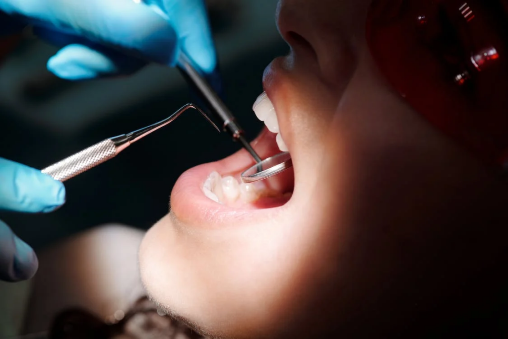 close-up shot of a person's mouth as the dentist examines the mouth with a dental mirror and sickle probe